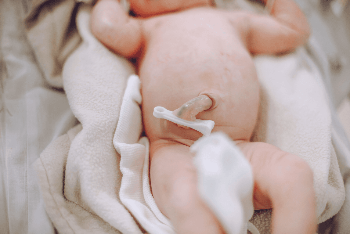 Neugeborenes mit Nabelschnur nach der Geburt, Doula Begleitung
